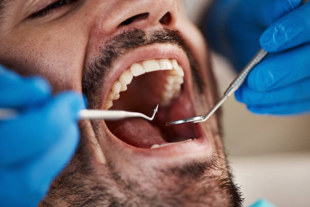 Best Emergency Dental Care for Trauma or Injury in Parklawn, CA