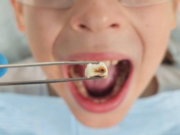 Best Emergency Dental Surgery in Parklawn, CA