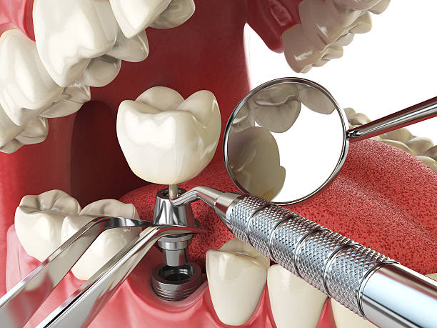 Best Walk-In Emergency Dentist in Parklawn, CA